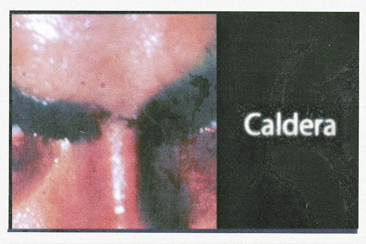 Caldera à Sala Jimmy Jazz Gasteiz Aretoa